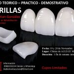 curso-practico-demostrativo-carillas