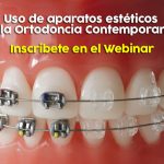 aparatos-esteticos-en-la-ortodoncia