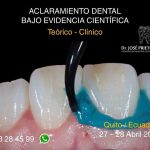 Curso Aclaramiento Dental Bajo Evidencia Científica en Quito