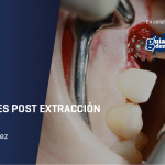 WEBINAR  Implantes post extracción