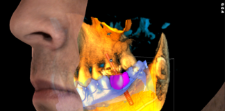 Diagnóstico Maxilofacial en 3D